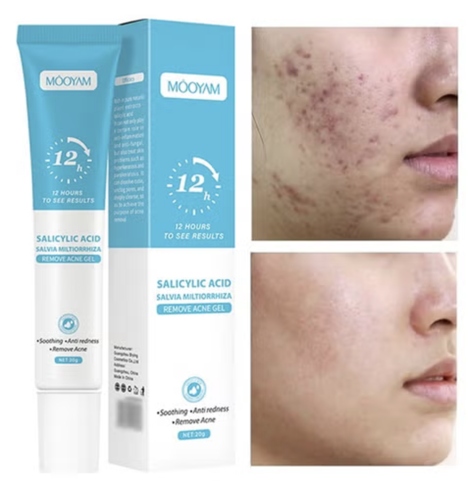 AcneZero Pro - Serum de Acido Salicilico - 12 Horas Resultados
