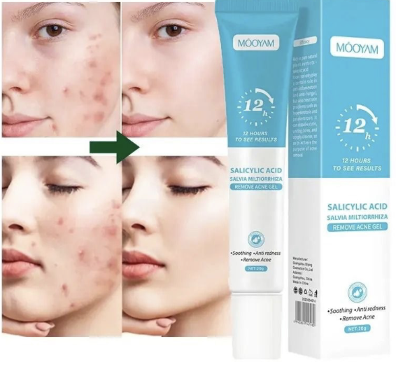 AcneZero Pro - Serum de Acido Salicilico - 12 Horas Resultados – Image 2